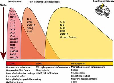 Inflammation Mediated Epileptogenesis as Possible Mechanism Underlying Ischemic Post-stroke Epilepsy